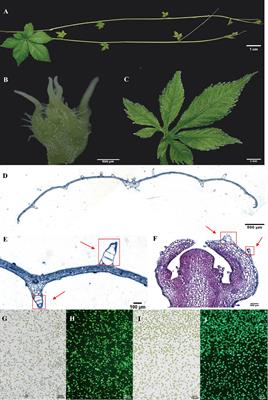 Single-cell transcriptome profiling reveals the spatiotemporal distribution of triterpenoid saponin biosynthesis and transposable element activity in Gynostemma pentaphyllum shoot apexes and leaves